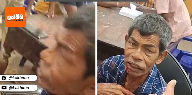 අපි ගැහුවෙ නෑ.. හොදටම බීලා පොලිසියට බයේ දුවද්දි වැටිලා..- පොලිසියෙන් කියයි…